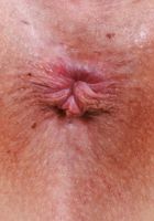 Dolly Paige from ATK Galleria